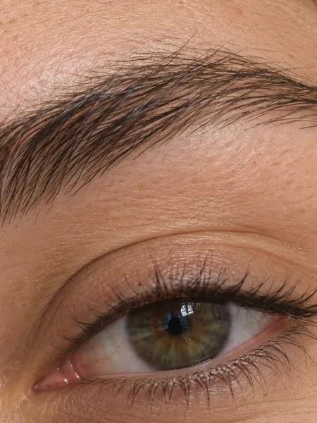 Fuller, healthier looking brow after a brow regrowth treatment